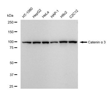 CTNNA3 Antibody in Western Blot (WB)