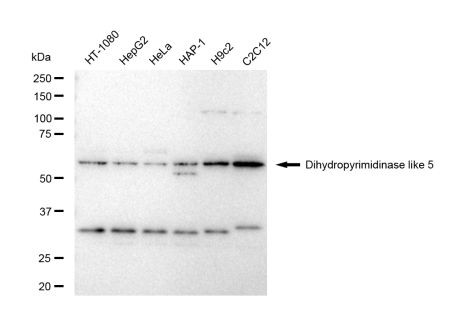 CRMP5 Antibody in Western Blot (WB)