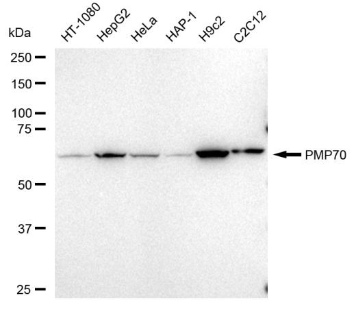 PMP70 Antibody in Western Blot (WB)