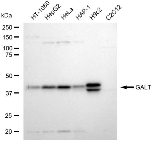 GALT Antibody in Western Blot (WB)