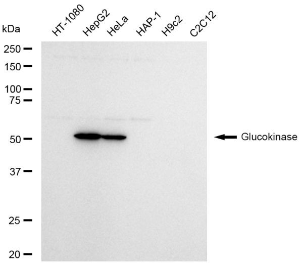 GCK Antibody in Western Blot (WB)