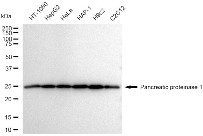 eIF3b Antibody in Western Blot (WB)