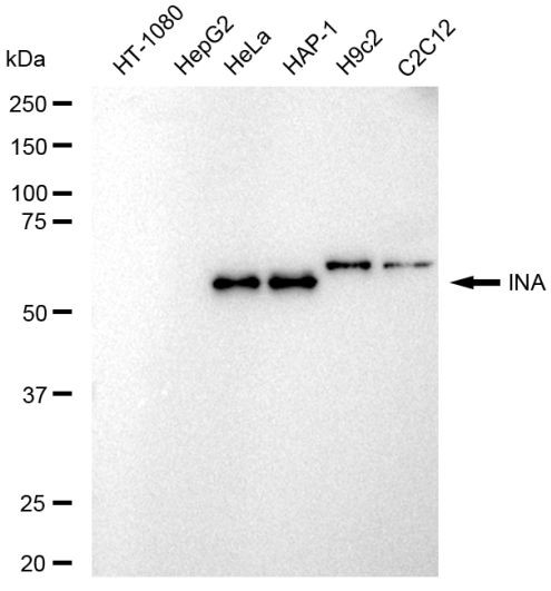 alpha Internexin Antibody in Western Blot (WB)