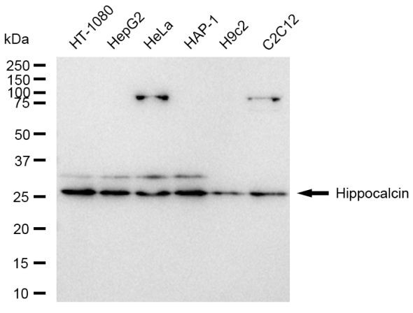 Hippocalcin Antibody in Western Blot (WB)