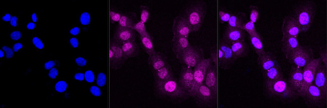 GRK6 Antibody in Immunocytochemistry (ICC/IF)