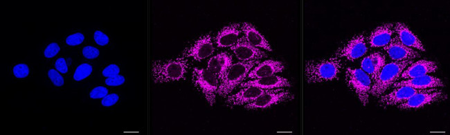 CD61 Antibody in Immunocytochemistry (ICC/IF)