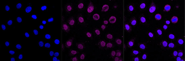 DAXX Antibody in Immunocytochemistry (ICC/IF)