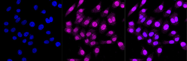 Angiopoietin 1 Antibody in Immunocytochemistry (ICC/IF)