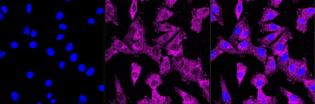 CaMKI Antibody in Immunocytochemistry (ICC/IF)