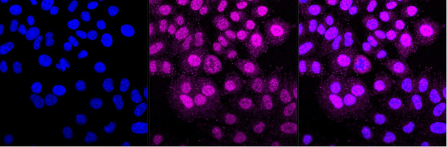 CDK5 Antibody in Immunocytochemistry (ICC/IF)