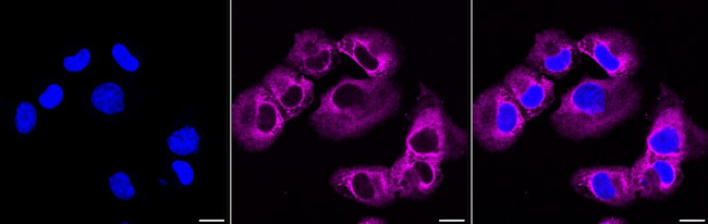 eIF3a Antibody in Immunocytochemistry (ICC/IF)