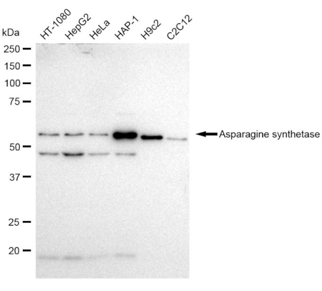 Asparagine Synthetase Antibody in Western Blot (WB)