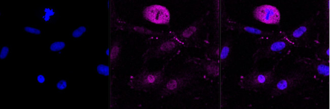 P-Glycoprotein Antibody in Immunocytochemistry (ICC/IF)