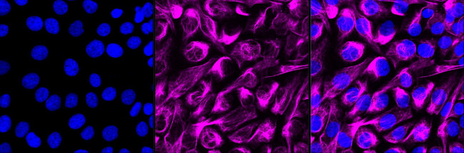 ACAP2 Antibody in Immunocytochemistry (ICC/IF)