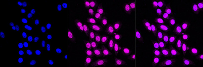 DJ-1 Antibody in Immunocytochemistry (ICC/IF)