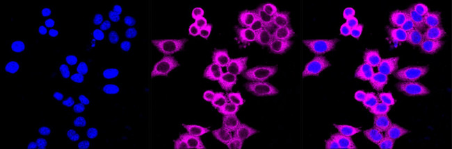 DIAPH1 Antibody in Immunocytochemistry (ICC/IF)