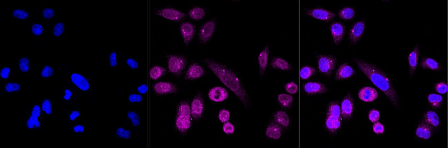 NUP155 Antibody in Immunocytochemistry (ICC/IF)