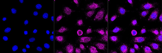 Calreticulin Antibody in Immunocytochemistry (ICC/IF)