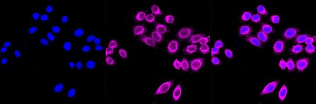 ROCK2 Antibody in Immunocytochemistry (ICC/IF)