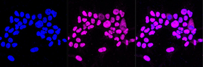 HAT1 Antibody in Immunocytochemistry (ICC/IF)