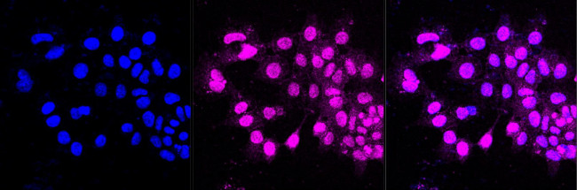 RAC3 Antibody in Immunocytochemistry (ICC/IF)