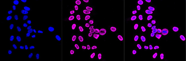 NME1 Antibody in Immunocytochemistry (ICC/IF)