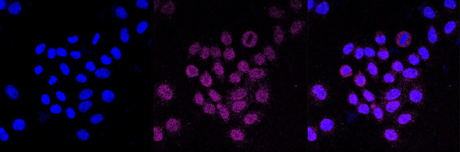 NME1 Antibody in Immunocytochemistry (ICC/IF)