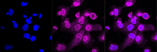 Caspase 3 Antibody in Immunocytochemistry (ICC/IF)