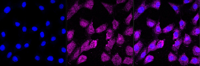 MDH2 Antibody in Immunocytochemistry (ICC/IF)