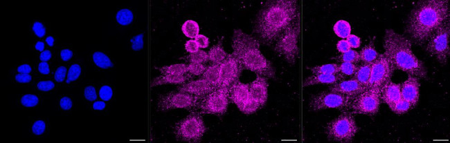 Cdc42 Antibody in Immunocytochemistry (ICC/IF)