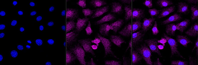 ADSS Antibody in Immunocytochemistry (ICC/IF)