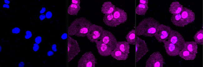 PAK2 Antibody in Immunocytochemistry (ICC/IF)