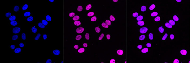 CAF1 p150 Antibody in Immunocytochemistry (ICC/IF)