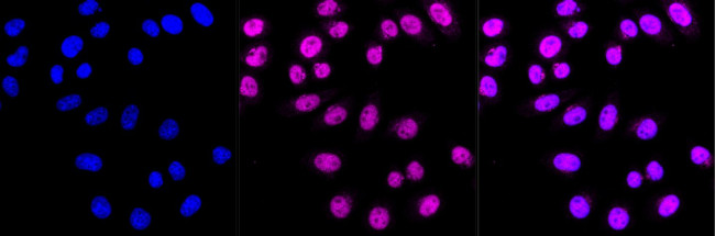 CHD4 Antibody in Immunocytochemistry (ICC/IF)