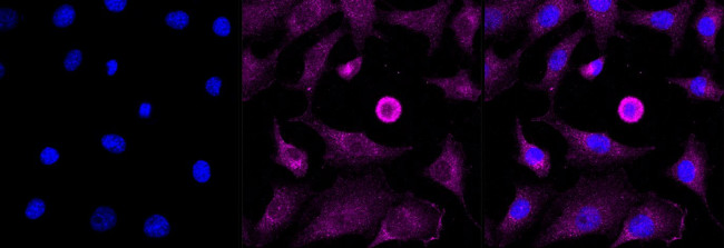 AP2S1 Antibody in Immunocytochemistry (ICC/IF)