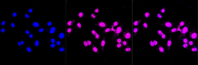 BRMS1 Antibody in Immunocytochemistry (ICC/IF)