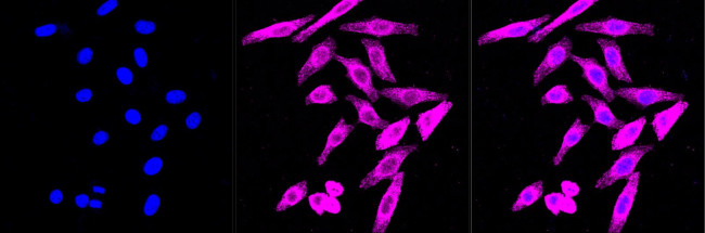 CLIP1 Antibody in Immunocytochemistry (ICC/IF)