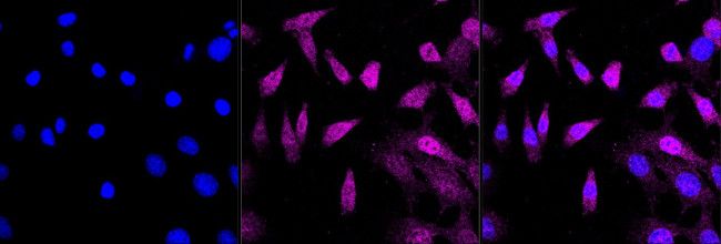 Androgen Receptor Antibody in Immunocytochemistry (ICC/IF)