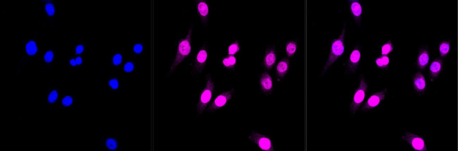 BIN1 Antibody in Immunocytochemistry (ICC/IF)