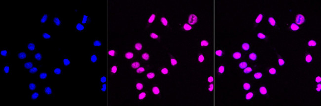 CHK2 Antibody in Immunocytochemistry (ICC/IF)