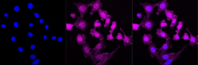 Catenin alpha-1 Antibody in Immunocytochemistry (ICC/IF)