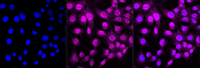 CTCF Antibody in Immunocytochemistry (ICC/IF)