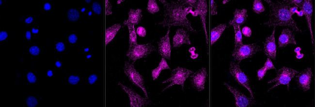 Mu-Calpain Antibody in Immunocytochemistry (ICC/IF)