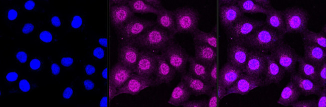 Calpain 2 Antibody in Immunocytochemistry (ICC/IF)