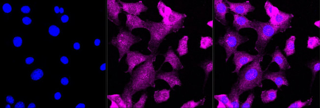 CSDE1 Antibody in Immunocytochemistry (ICC/IF)