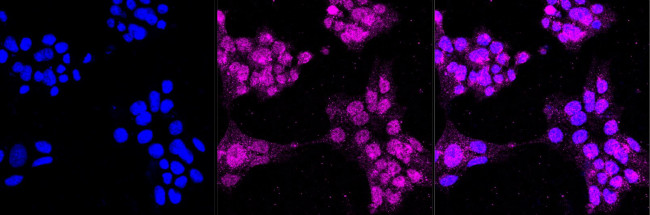 Fe65 Antibody in Immunocytochemistry (ICC/IF)