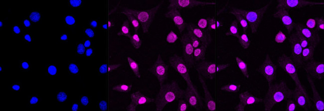 AP2S1 Antibody in Immunocytochemistry (ICC/IF)