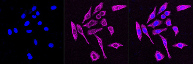 CD97 Antibody in Immunocytochemistry (ICC/IF)