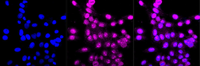 ARF5 Antibody in Immunocytochemistry (ICC/IF)