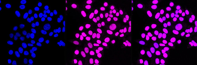 HLTF Antibody in Immunocytochemistry (ICC/IF)